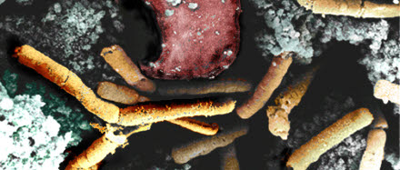 Färgförstärkt elektromikroskopbild av mjältbrandsdrabbad vävnad. Bilden är en del av forsvarasmakten.se/varhistoria.